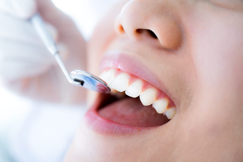 dental checkup