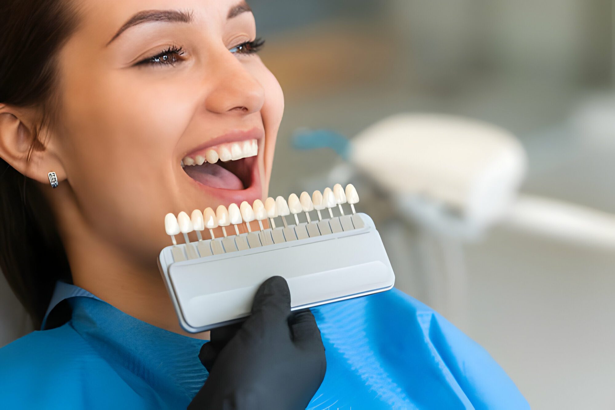 dentist checking teeths shade with the help of dental tool